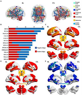 Aberrant individual structure covariance network in patients with mesial temporal lobe epilepsy